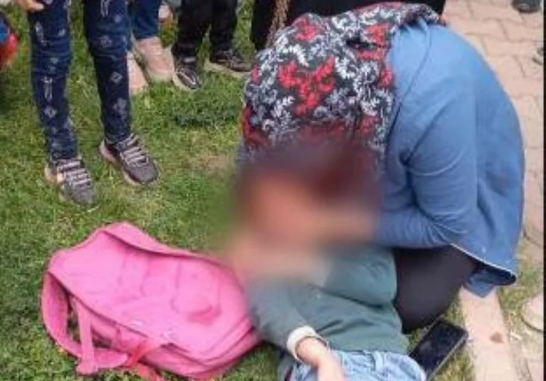 Kayseri'de Otomobil Yoldan Geçen Çocuğa Çarptı — haber görseli
