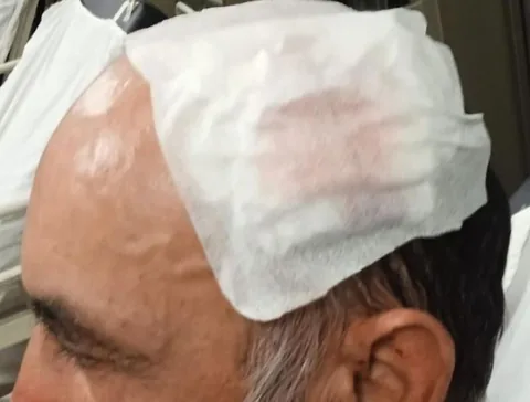 Sarıoğlan'da Neler Oluyor? Belediye Başkanı Eleştiren Şahıs Darp Mı Edildi!  — haber görseli