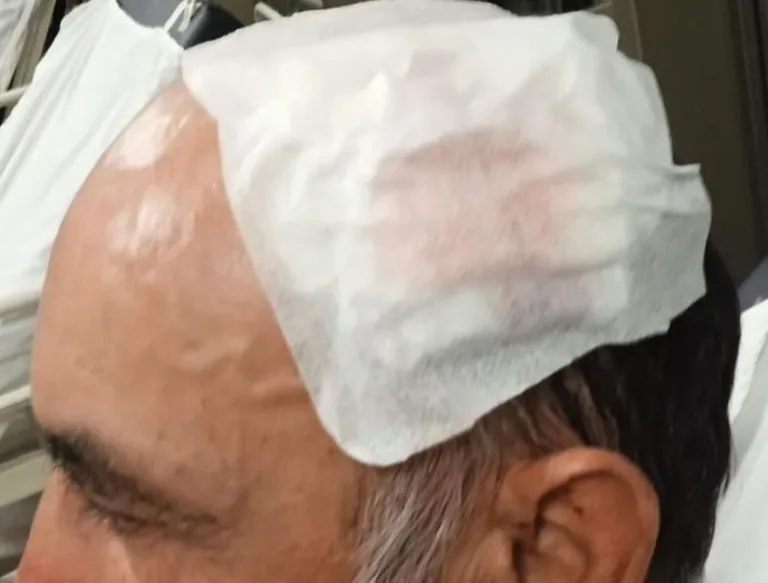 Sarıoğlan'da Neler Oluyor? Belediye Başkanı Eleştiren Şahıs Darp Mı Edildi! — haber görseli