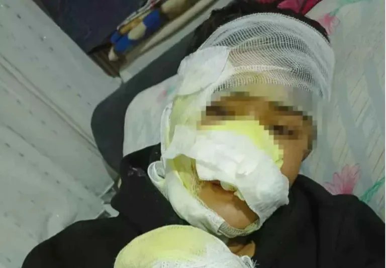 Bünyan'da İnsanlık Dışı Şaka: 16 Yaşındaki Çocuğu Fırına Kilitlediler: Çocuk Yanıklarla Kurtuldu — haber görseli