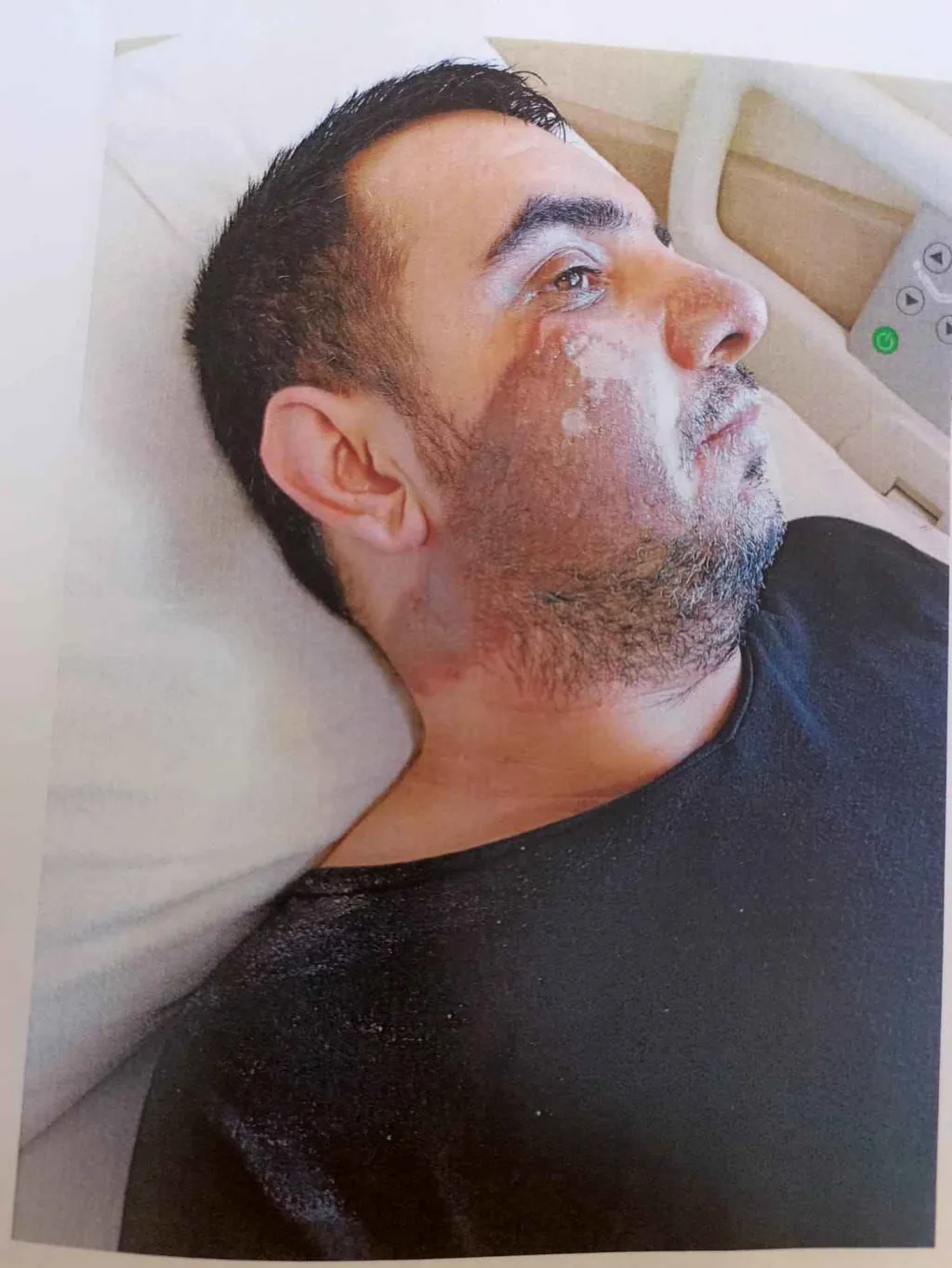 Şevket Ateş’in Ölüm Nedeni: Grip Mi, Kimyasal Yanık Mı? Aile Adalet Arıyor — haber görseli