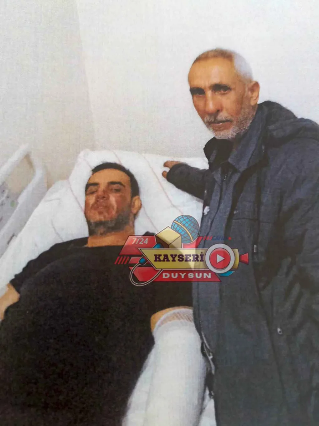 Şevket Ateş’in Ölüm Nedeni: Grip Mi, Kimyasal Yanık Mı? Aile Adalet Arıyor — haber görseli
